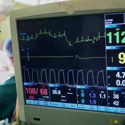 Bilde av en skjerm med tall og hjerterytmekurver.