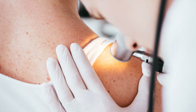 Lege som ser på en pasients skulder via et dermatoskop. 