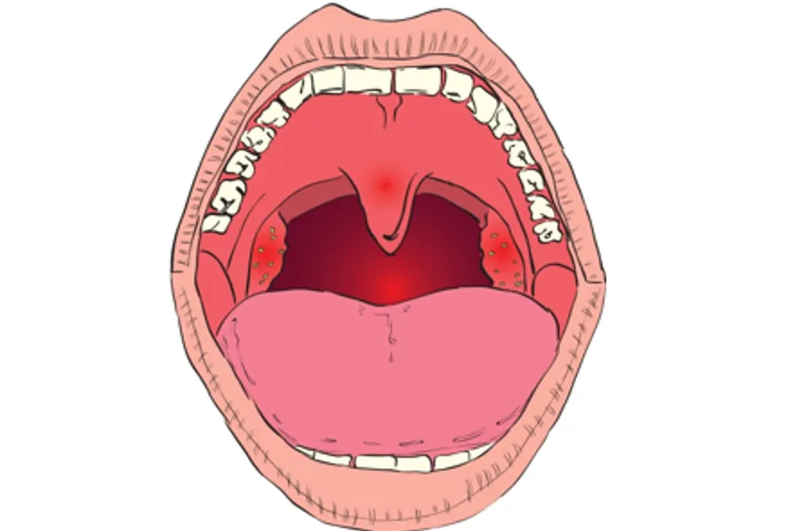 Illustrasjon av en gapende munn.
