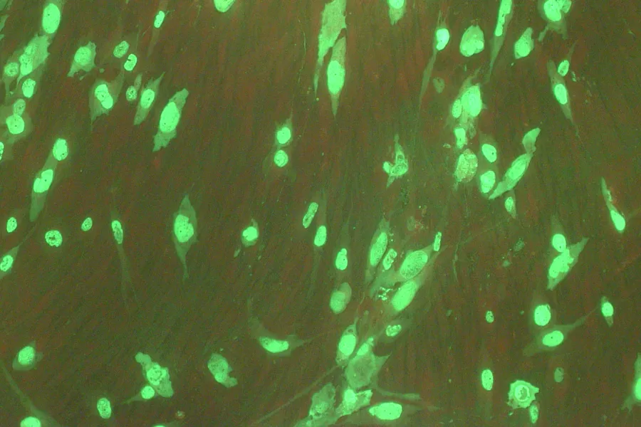 Forsidebilde Labnytt nr. 4 2023 - bilde av HE-celler infisert med adenovirus