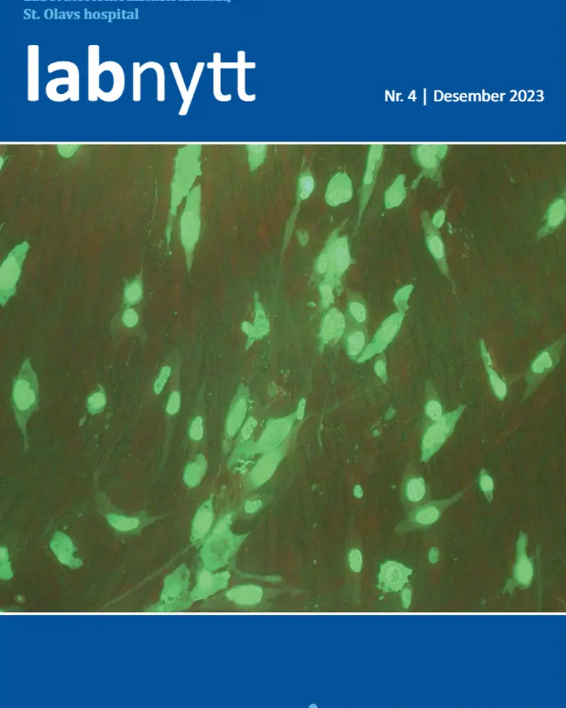 Forsidebilde Labnytt nr. 4 2023 - bilde av HE-celler infisert med adenovirus